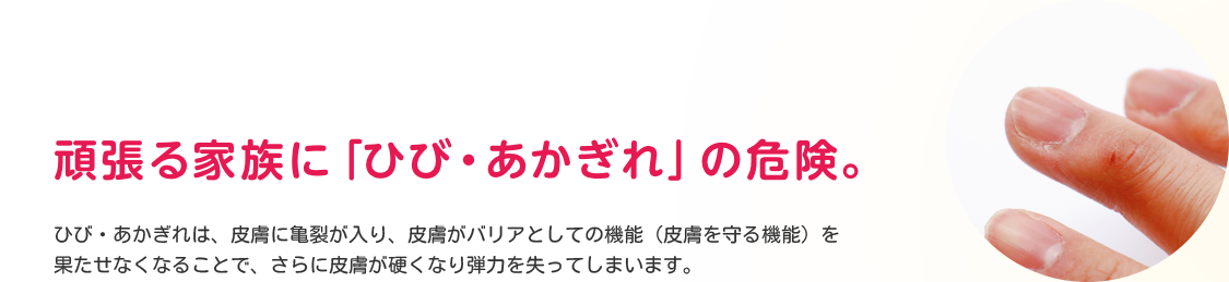 頑張る家族に「ひび・あかぎれ」の危険。ひび・あかぎれは、皮膚に亀裂が入り、皮膚がバリアとしての機能（皮膚を守る機能）を果たせなくなることで、さらに皮膚が硬くなり弾力を失ってしまいます。