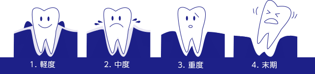 軽度＞中度＞重度＞末期